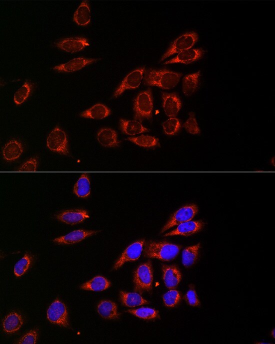 Citidine Deaminase Antibody