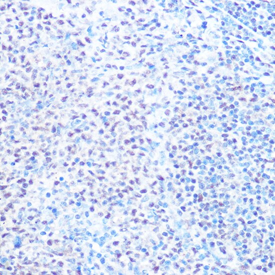 SNRPB Antibody