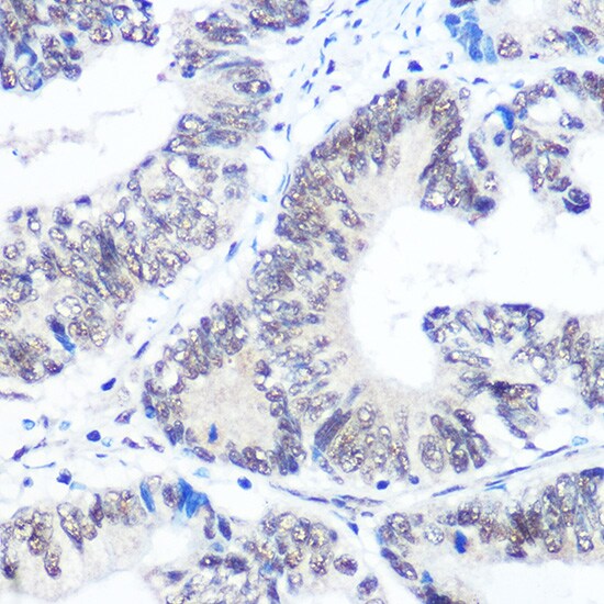 SNRPB Antibody