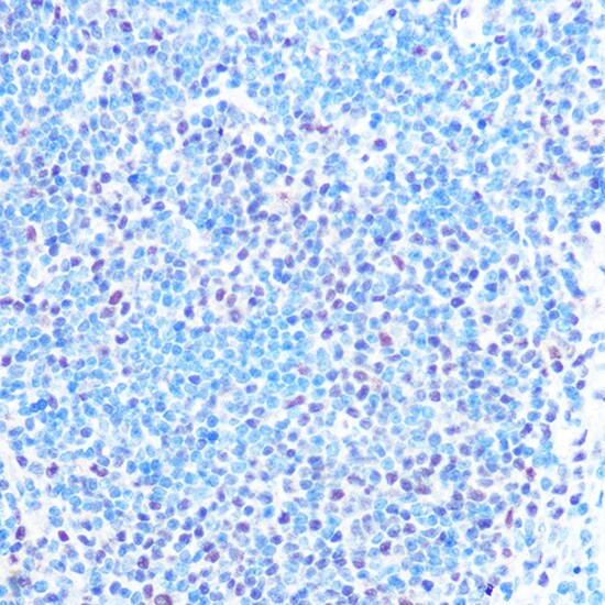 SNRPB Antibody