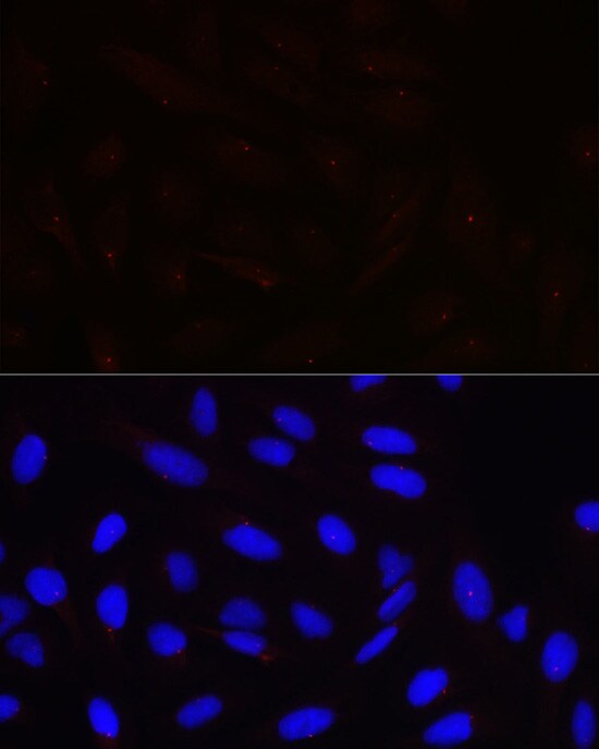 Pericentrin Antibody