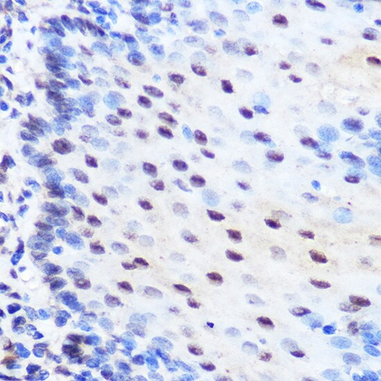 ZNF207 Antibody