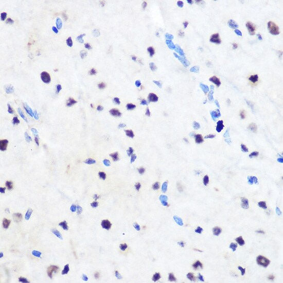 ZNF207 Antibody