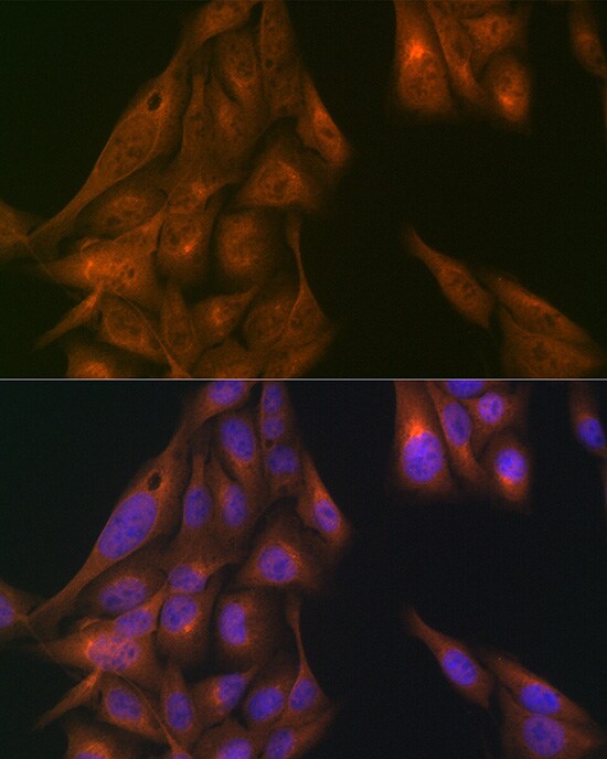 USP11 Antibody
