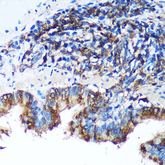 FBXO21 Antibody