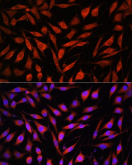 FBXO21 Antibody