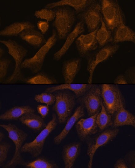 SHMT1 Antibody