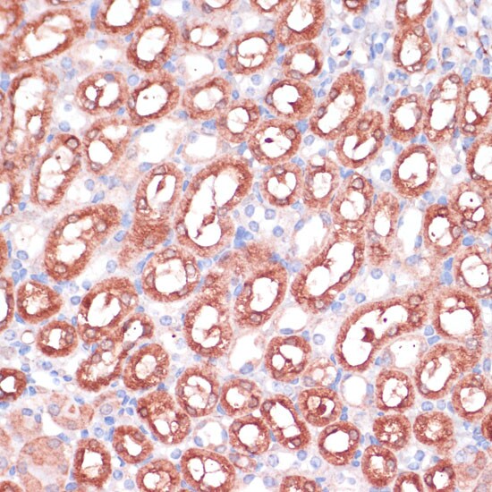 SHMT1 Antibody