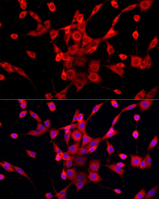 PEX5 Antibody