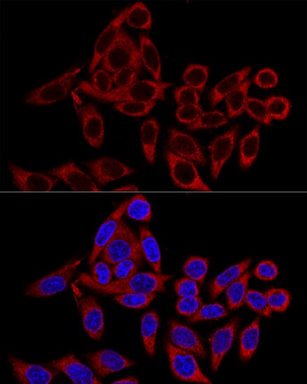 RRBP1 Antibody