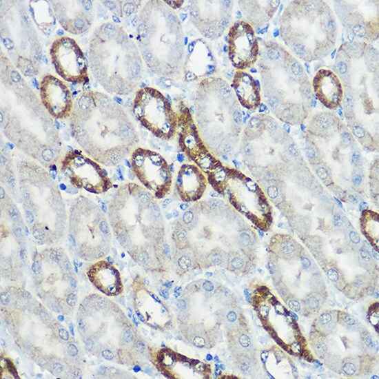 IP6K1 Antibody