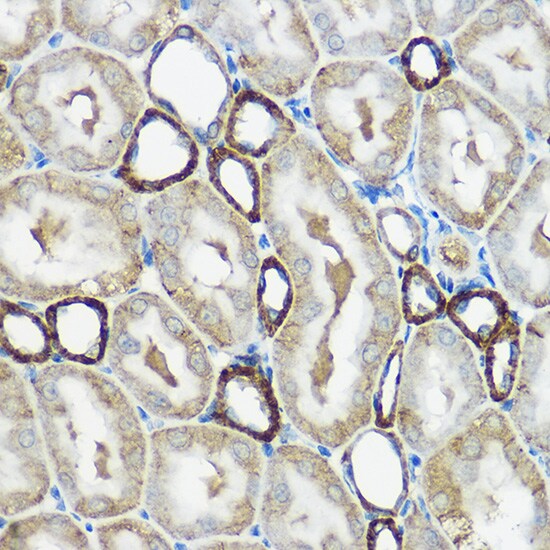 IP6K1 Antibody