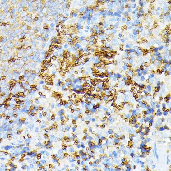 Spectrin alpha 1 Antibody