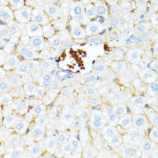 Spectrin alpha 1 Antibody