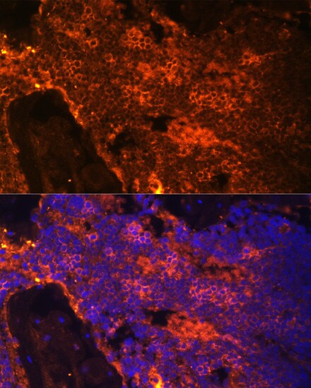 Spectrin alpha 1 Antibody
