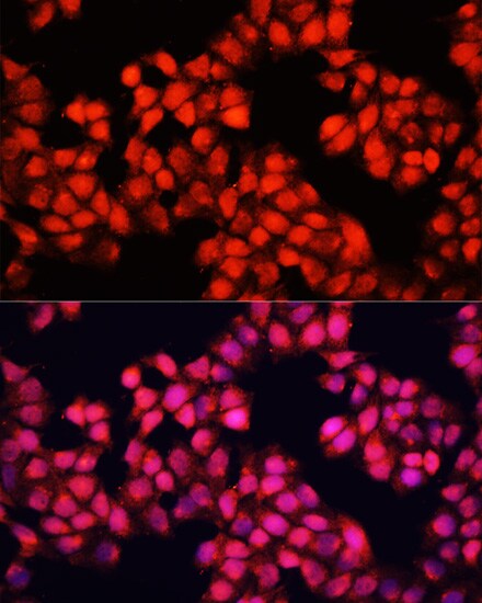 ALAD Antibody