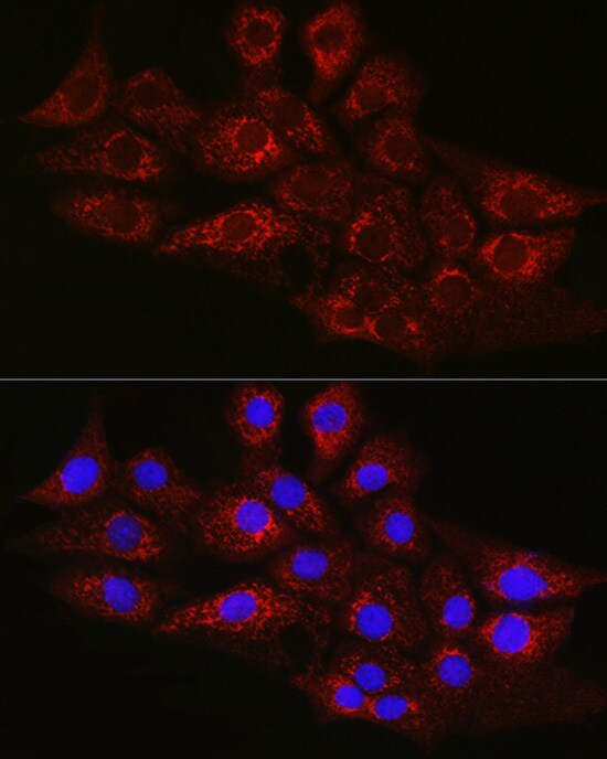CPT2 Antibody