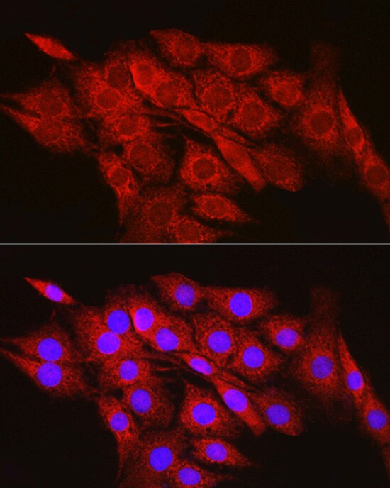 CPT2 Antibody