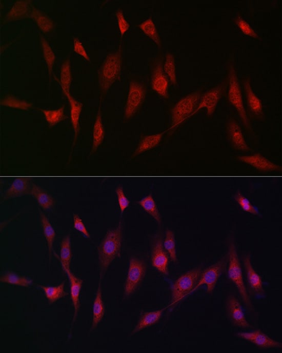 Methionine Sulfoxide Reductase A Antibody