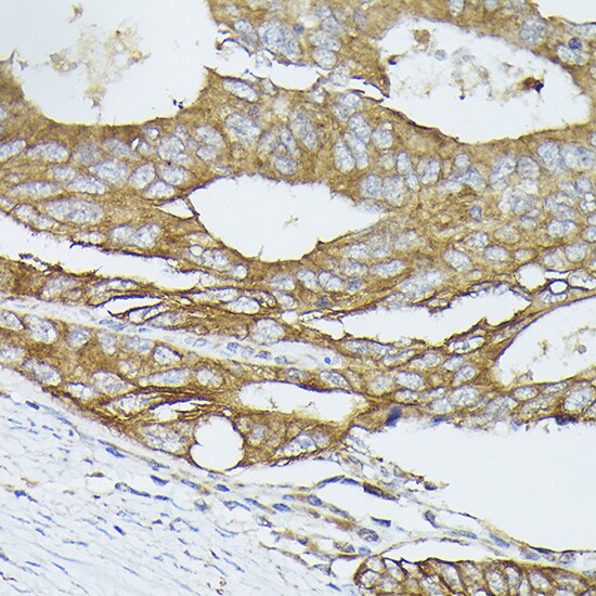 PIK3CA Antibody