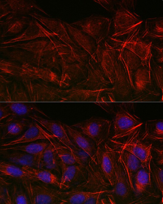Acidic Calponin Antibody