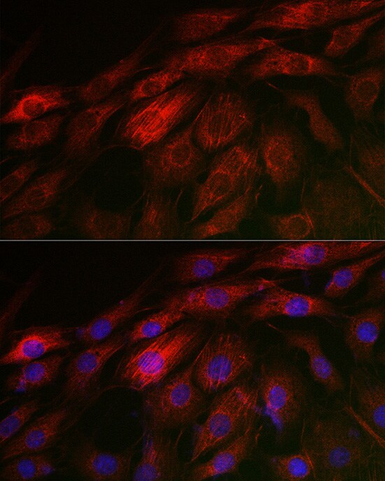 Acidic Calponin Antibody