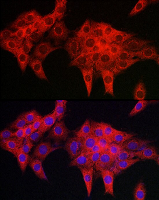 PDLIM4 Antibody