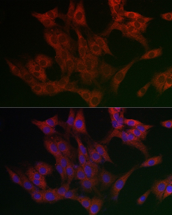 ETEA Antibody
