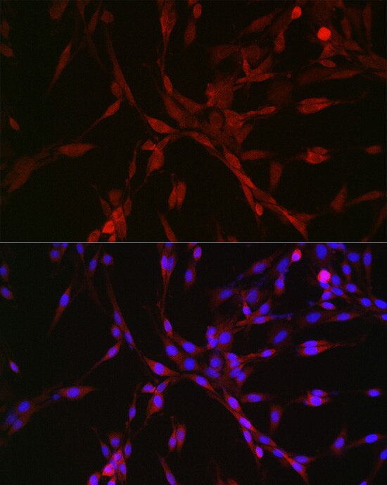 GATSL3 Antibody