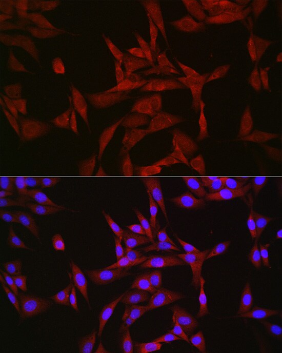 GATSL3 Antibody