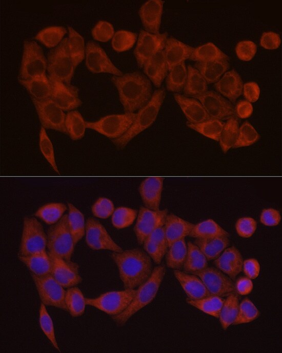 SDHC Antibody