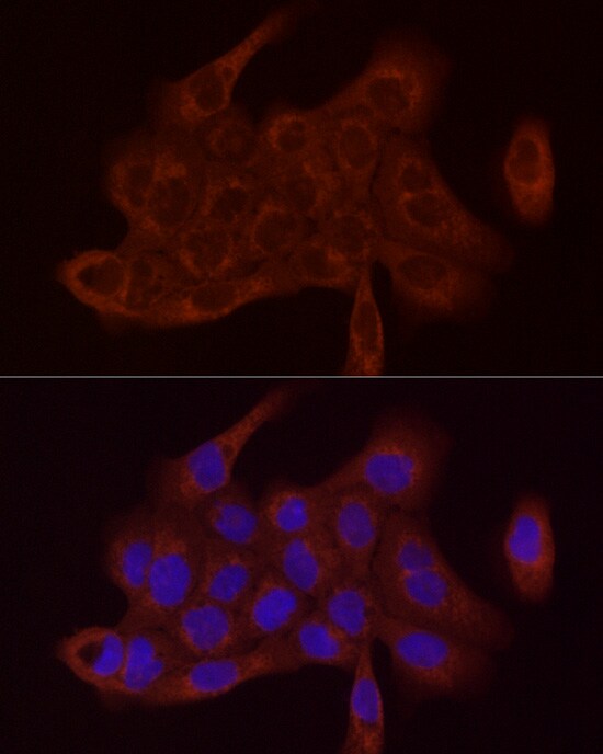 SDHC Antibody