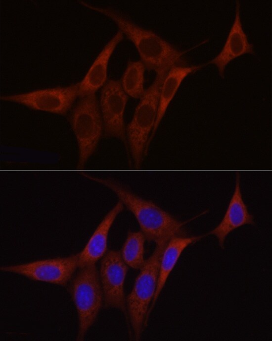 SDHC Antibody