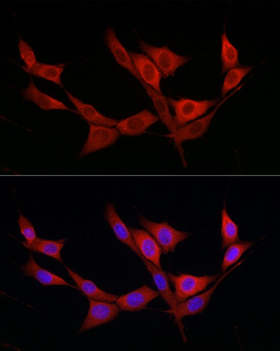 katanin-p80 Antibody