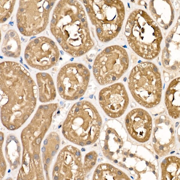 Sorbitol Dehydrogenase Antibody