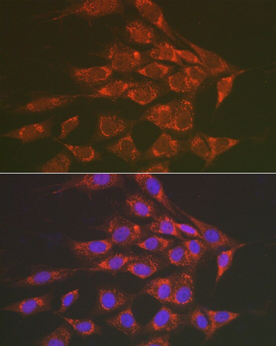 Sorbitol Dehydrogenase Antibody