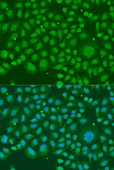 hnRNP-R Antibody