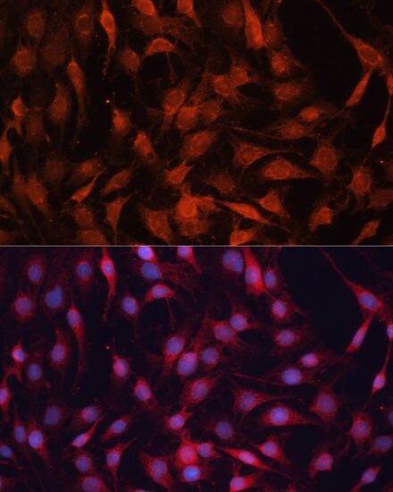 G protein alpha-13 Antibody