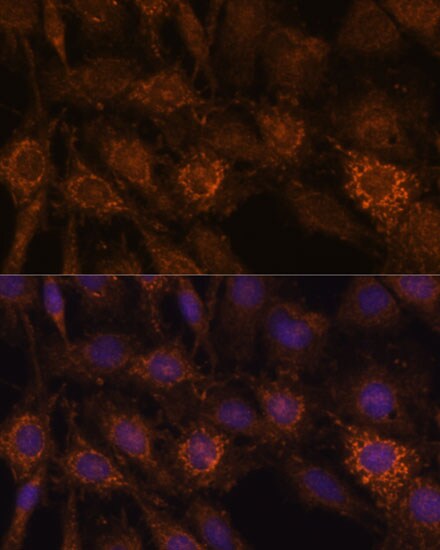 HIBADH Antibody