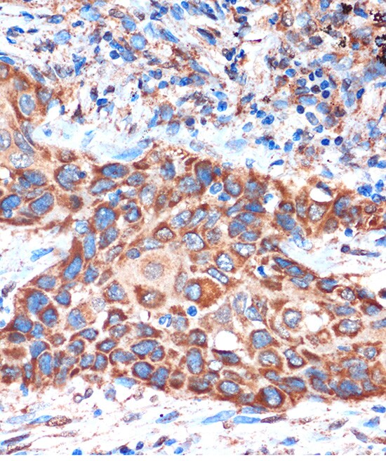 HIBADH Antibody