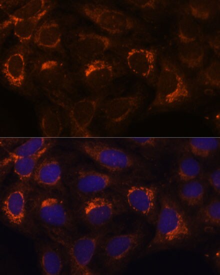 HIBADH Antibody
