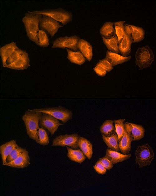 STRAP Antibody