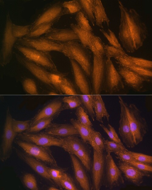 STRAP Antibody