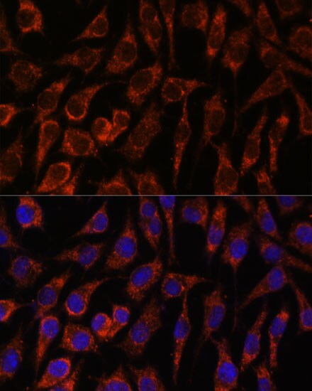 NUP210 Antibody
