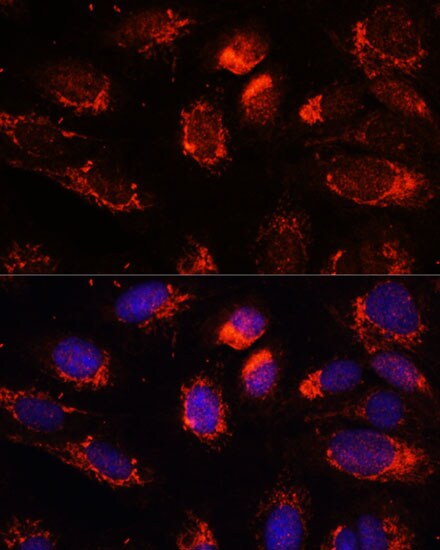 NUP210 Antibody