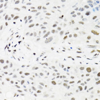 HTF9C Antibody