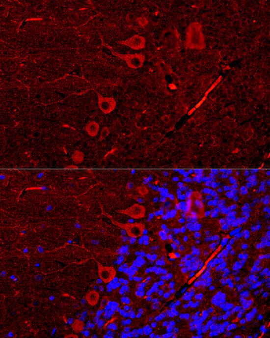 IP3R1 Antibody