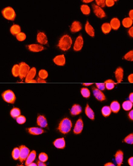 Glutathione S Transferase kappa 1 Antibody
