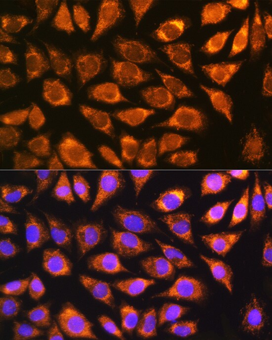 NDUFS5 Antibody