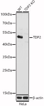 ETS1 associated protein II Antibody